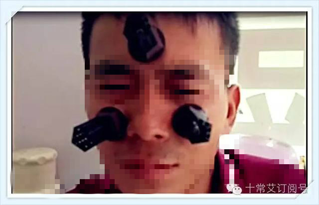 秋天防鼻炎的最佳方法,鼻炎灸艾灸灸什么部位