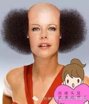 中老年人脱发掉发严重怎么办,脱发严重如何中药调理