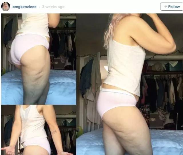 中国品味红黑榜（黑榜三）：以瘦为美，这畸形的时尚！