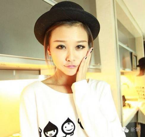 网红做双眼皮变化,整双眼皮成功的网红