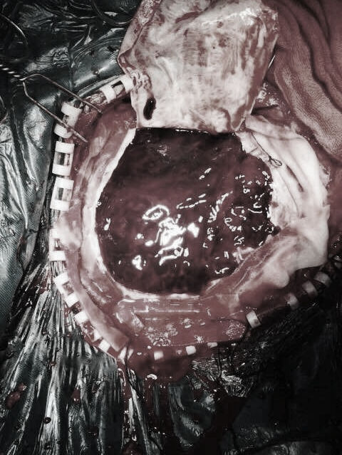 解放军306医院除夕之夜倒计时与正计时