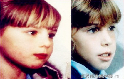 为什么我家孩子下巴短,孩子下巴短改善案例