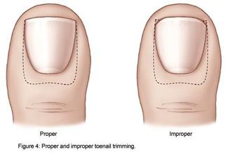 神奇的嵌甲,巨大隐藏嵌甲