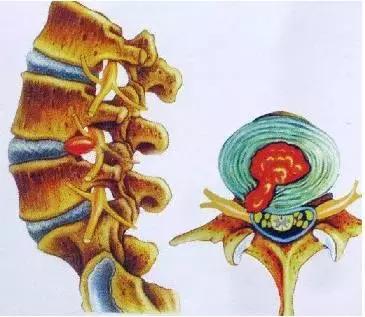 练一练,远离腰痛(腰椎锻炼手册)