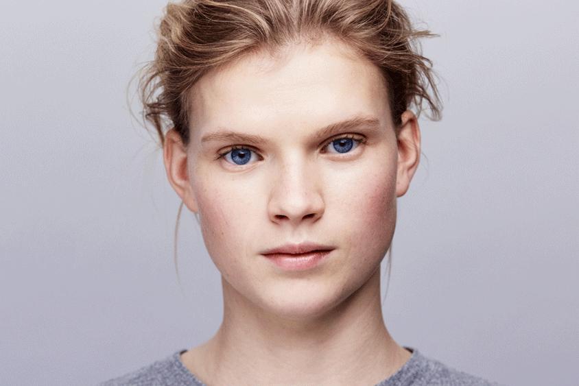 为什么挤黑头会感觉快感,挤黑头为什么看得那么清楚