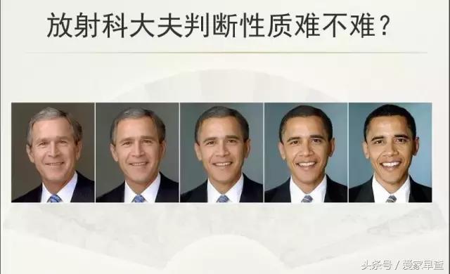 布什还是奥巴马？放射科杨大夫谈体检查出的结节和囊肿