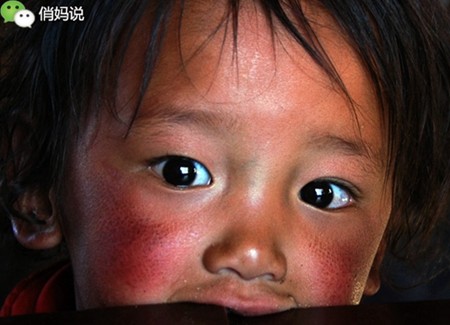 好用的宝宝润肤霜,宝宝干性湿疹用什么润肤霜