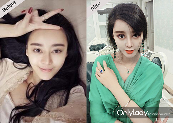 女子花4万块整容把嘴都整歪了,美国女子花76万整容