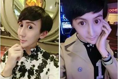 蛇精脸鼻祖刘梓晨恢复审美,和刘梓晨同期的蛇精脸