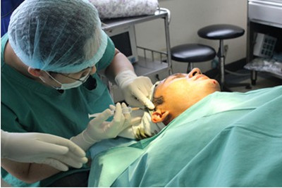 自体脂肪丰太阳穴和玻尿酸哪个好,为什么玻尿酸填充越多越持久