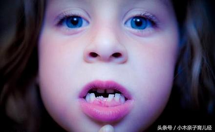 婴儿牙缝宽能塞硬币吗,宝宝牙缝宽能塞硬币吗