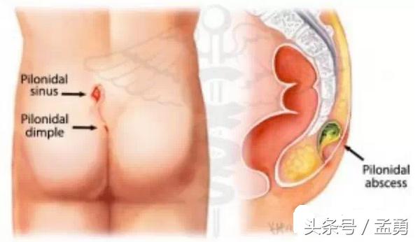 吉普车都有哪些小毛病,吉普车综合症是什么意思