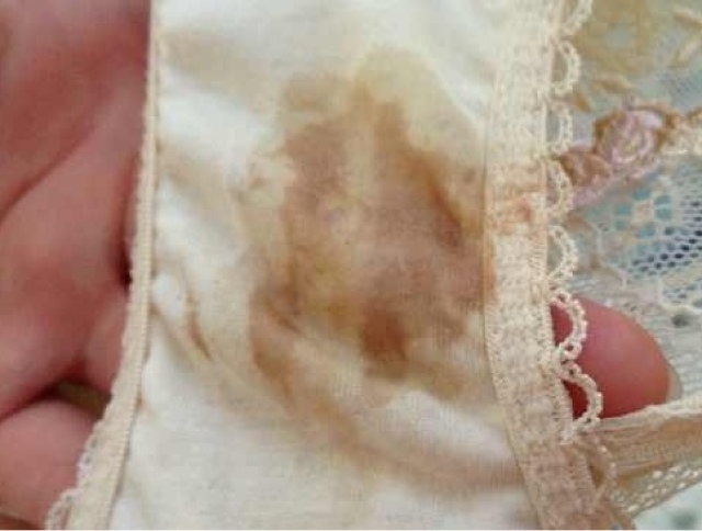 孕晚期出血住院时如何保胎,孕晚期出血的原因有哪些