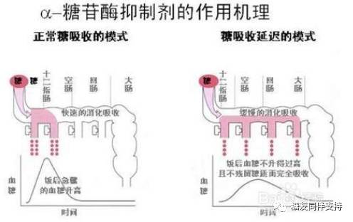 糖尿病预防采取全人群预防策略,糖尿病看中医如何防控糖尿病