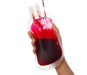 血型为rh阳性怎么输血,血型为rh阴性