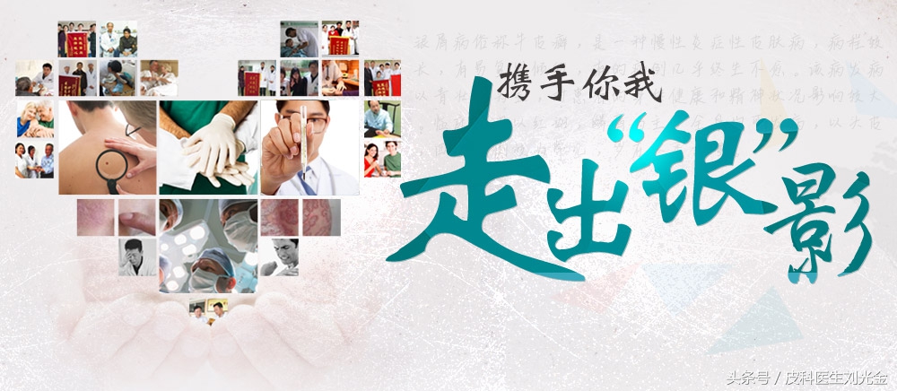 张佩芳中医,张书元治银屑病秘方