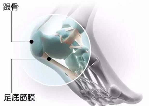 足底筋膜炎康复训练,脚筋膜炎运动康复训练