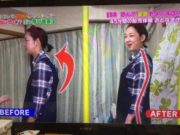 为了治颈椎，日本人民连“木乃伊套餐”都用上了