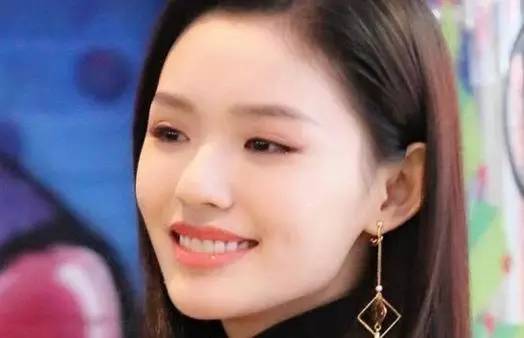 林允整牙却像整容？她是真的又整了啊！