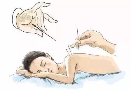 乳腺术后潮热是怎么回事？