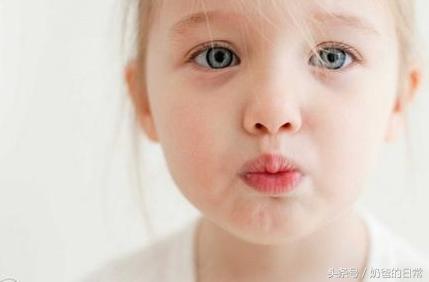 小孩突然失语不能动过一会恢复,宝宝突然晕厥失去意识