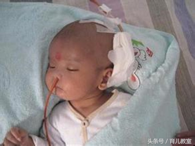 1岁多小孩摔一跤摔到头吐了,孩子摔了一跤呕吐不止