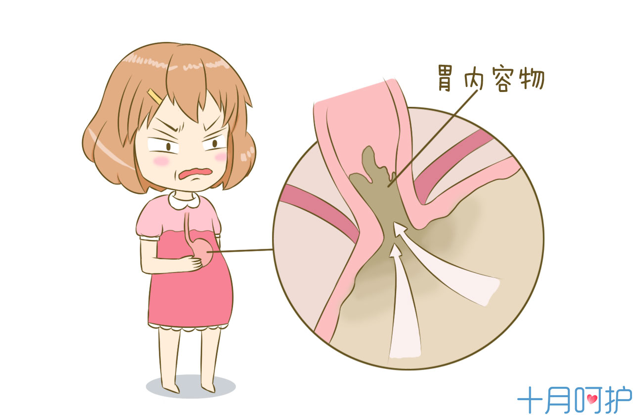 孕期反酸怎么缓解做什么运动,孕期如何解决胃反酸现象