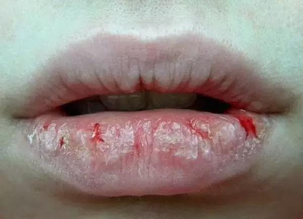 嫌用唇膏不够man的男人,注定吻不上心爱姑娘的唇