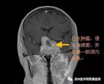 滨医附院神经介入外科,滨医神经外科住院部