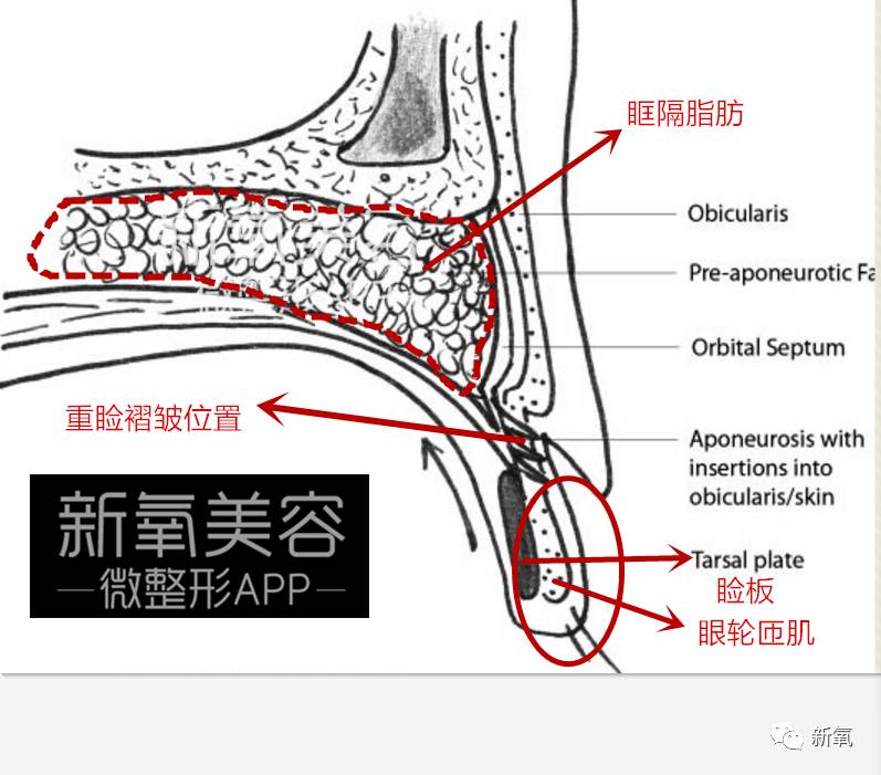连范冰冰的脸都驾驭不了欧式平行大双，为什么？