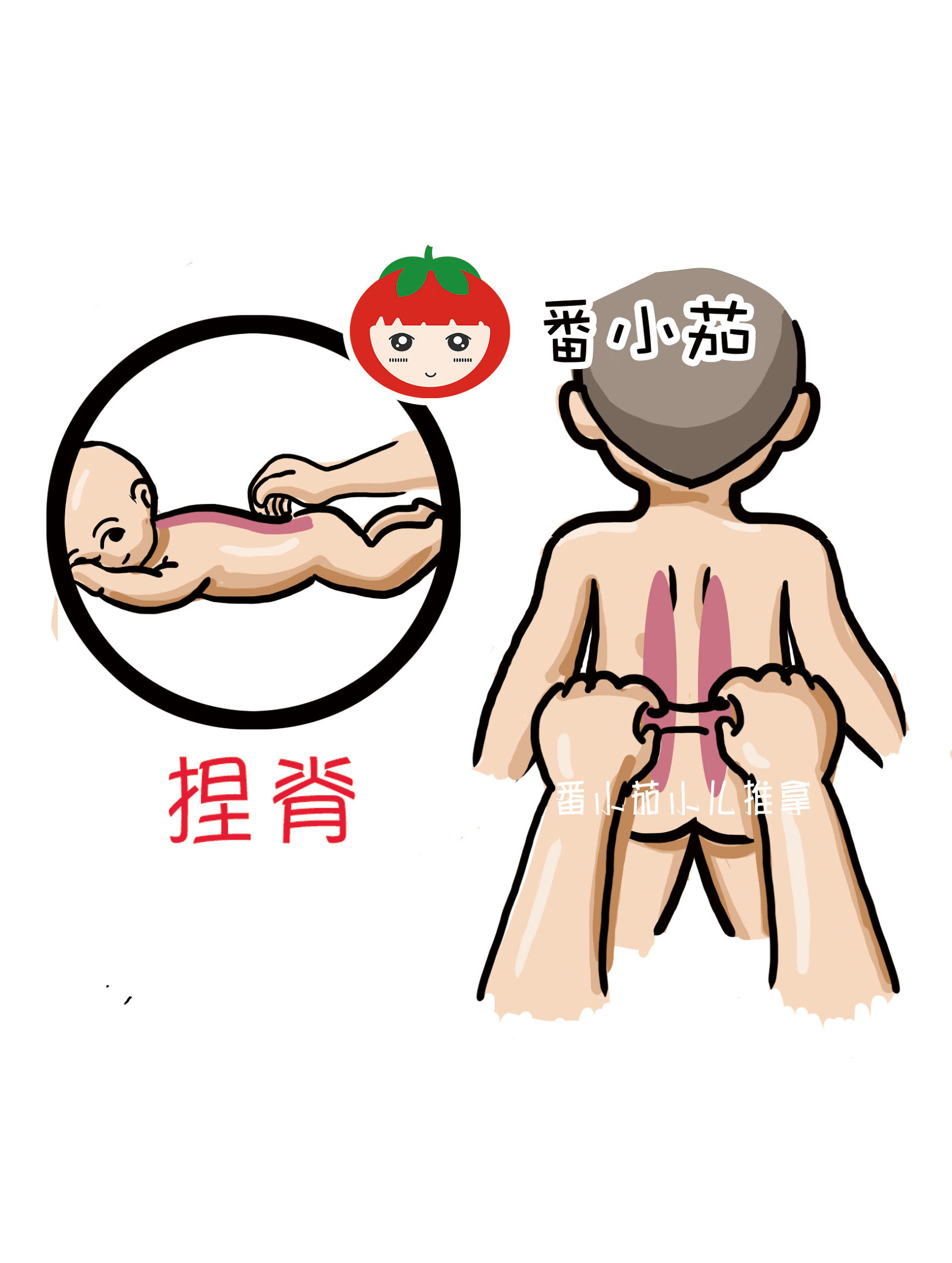 小儿推拿鼻炎腺样体肥大手法,宝宝鼻炎腺体肥大推拿