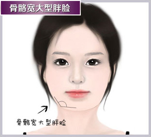 大肥脸变瘦脸的神器,光纤溶脂瘦脸后朋友看不出来效果