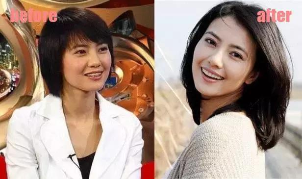 整牙=整容?看杨幂、刘涛、高圆圆为你亲身示范!