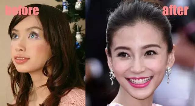 整牙=整容?看杨幂、刘涛、高圆圆为你亲身示范!