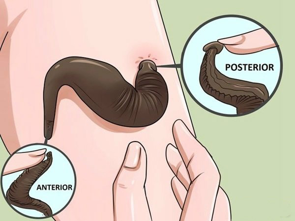 能杀死水体寄生虫的中草药,嗜血虫子