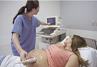 孕期做B超，这些问题一定要注意！