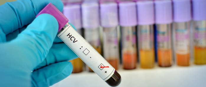 hcv特效药,hpv药研发到什么进度了