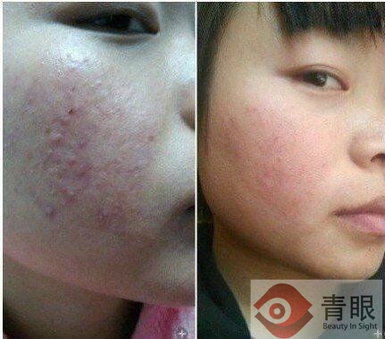 化妆品导购说我是“厚”脸皮,我竟无言以对