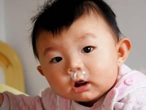 风寒感冒针刺放血注意事项,通过放血治疗疾病方法可取吗