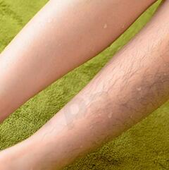 女生快速去除腿毛的小妙招,如何彻底去除腿毛女生