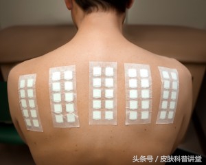 反复过敏要警惕,反复过敏但测过敏源不过敏