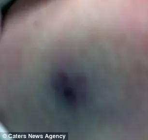 澳洲大蜘蛛咬人死亡,澳大利亚被蜘蛛咬死