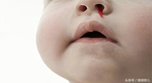 育儿经验分享孩子容易流鼻血,小孩流鼻血怎么快速止血倪海厦