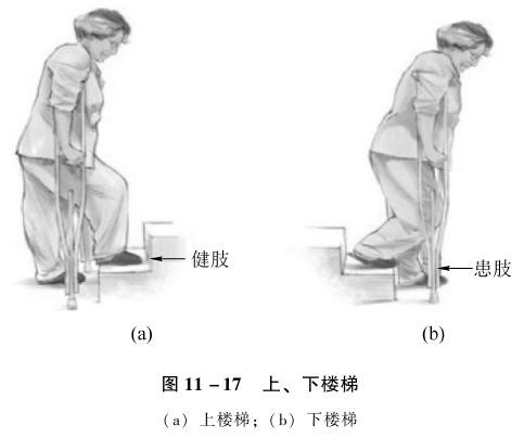 老年运动系统疾病的照护：常见部位骨折的照护要点（二）