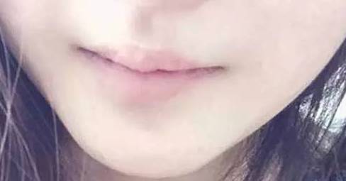 一旦嘴唇变成这种颜色就要警惕,嘴唇发黄要警惕这是一种常见疾病