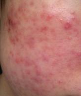 刘歪歪脱骨凤爪凉拌菜,刘歪歪的作品原声