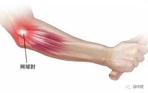 春季提醒幼儿适当锻炼的温馨提示,春季锻炼身体的温馨提示