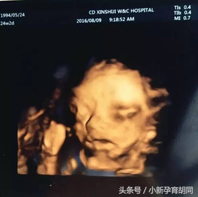 顺产日记小宝宝,顺产日记出生了男宝