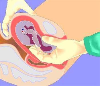 女人生孩子宫缩到底有多痛,顺产生孩子的痛感