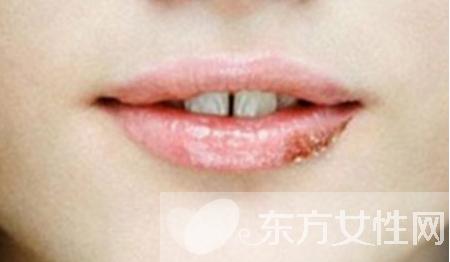 嘴上经常上火起泡什么原因,嘴上起泡是什么原因该怎么治疗